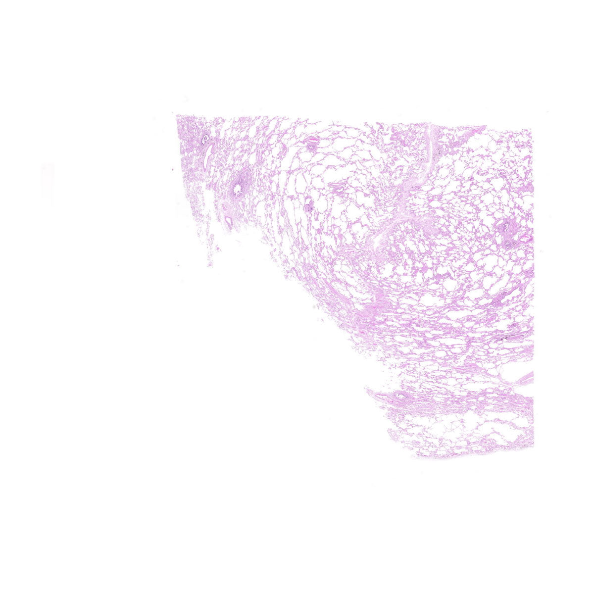 Human FFPE NAT Lung Tissue HuN-15-0099B