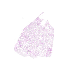 Human FFPE NAT Lung Tissue HuN-15-0101