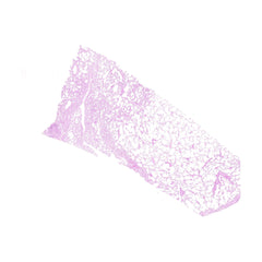 Human FFPE NAT Lung Tissue HuN-15-0102