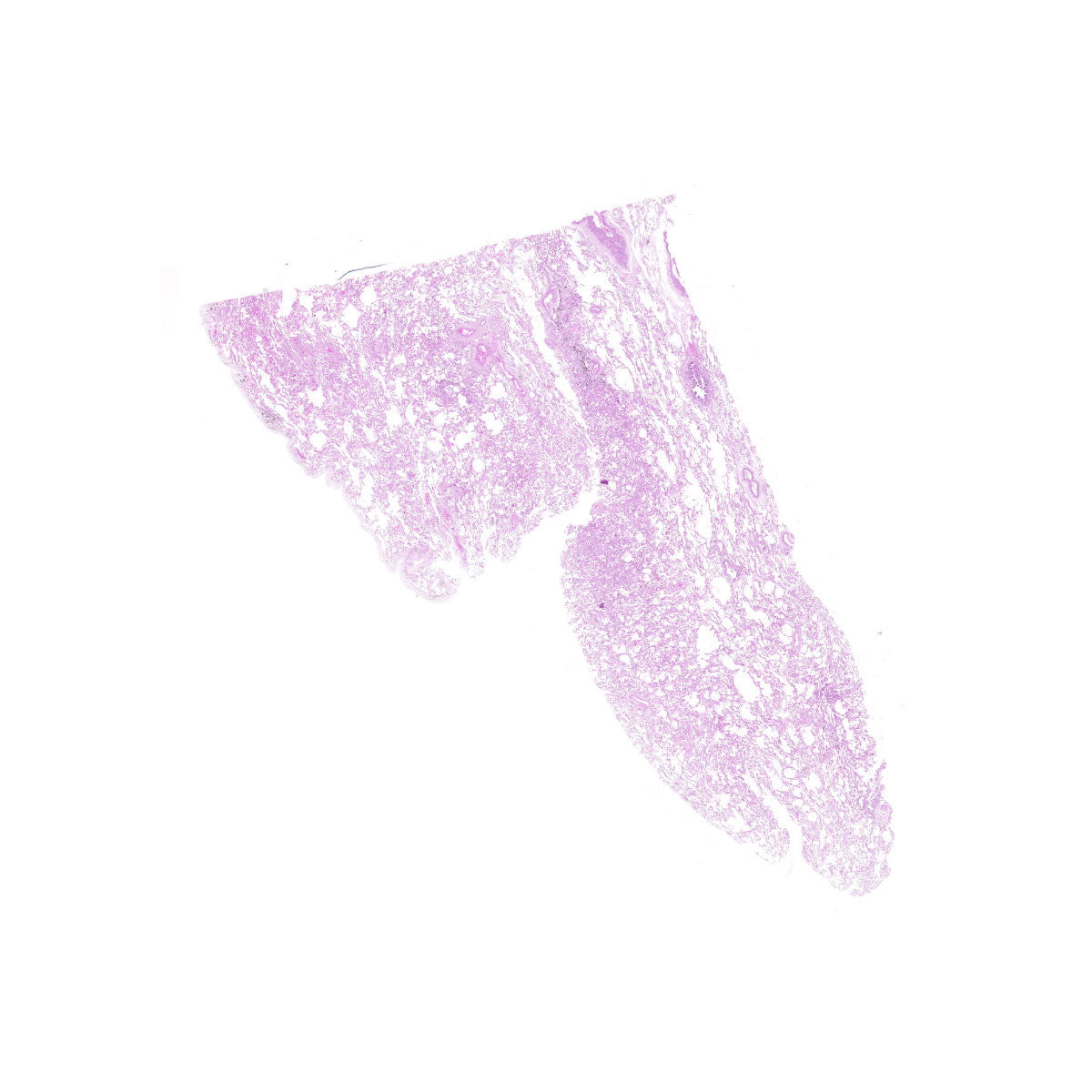 Human FFPE NAT Lung Tissue HuN-15-0103