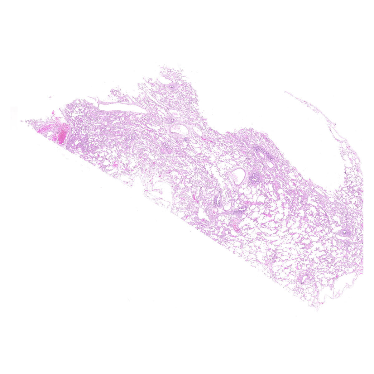 Human FFPE NAT Lung Tissue HuN-15-0104
