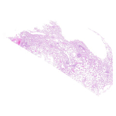 Human FFPE NAT Lung Tissue HuN-15-0104