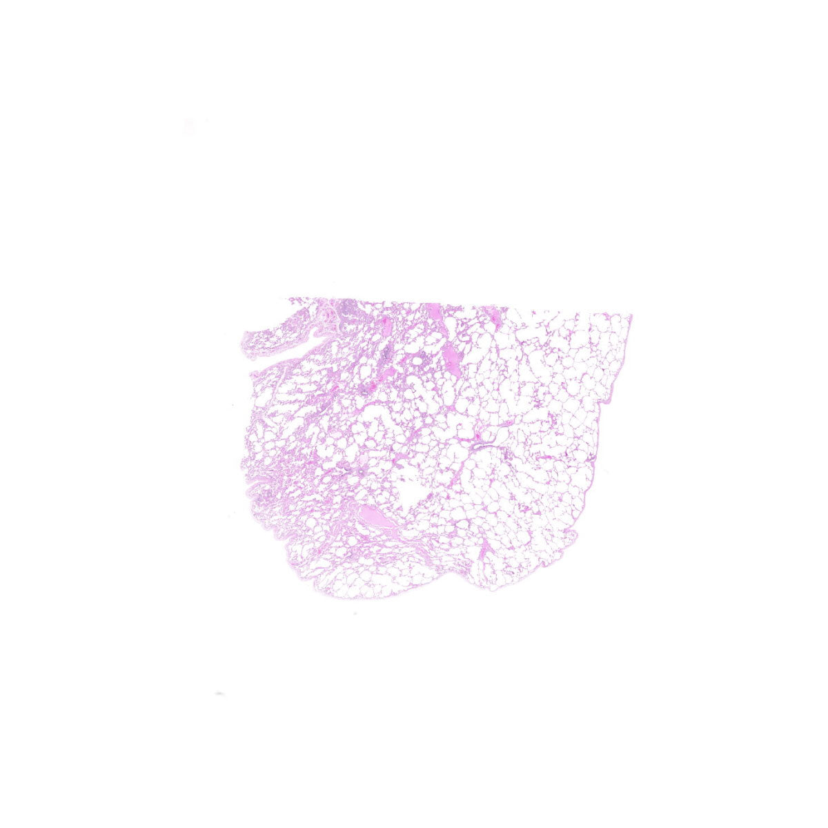 Human FFPE NAT Lung Tissue HuN-15-0105