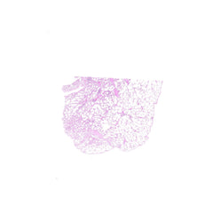 Human FFPE NAT Lung Tissue HuN-15-0105