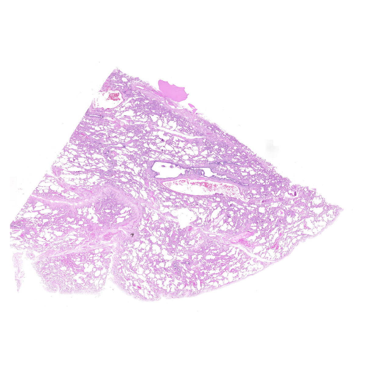 Human FFPE NAT Lung Tissue HuN-15-0107