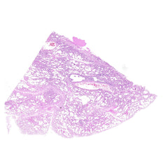 Human FFPE NAT Lung Tissue HuN-15-0107