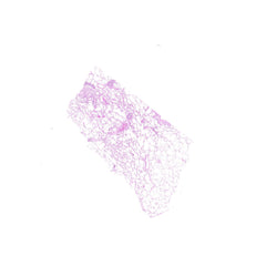 Human FFPE NAT Lung Tissue HuN-15-0108A