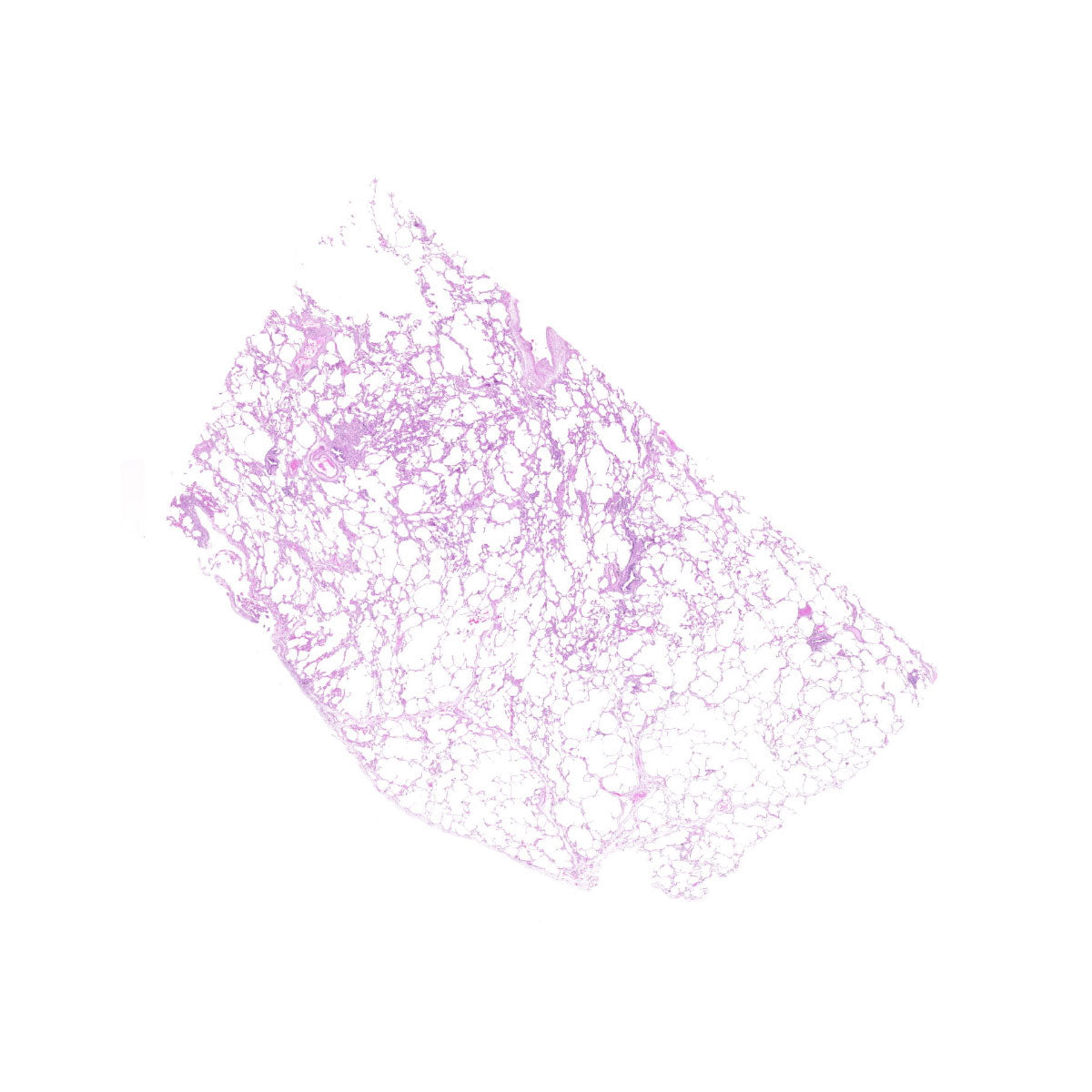 Human FFPE NAT Lung Tissue HuN-15-0108B