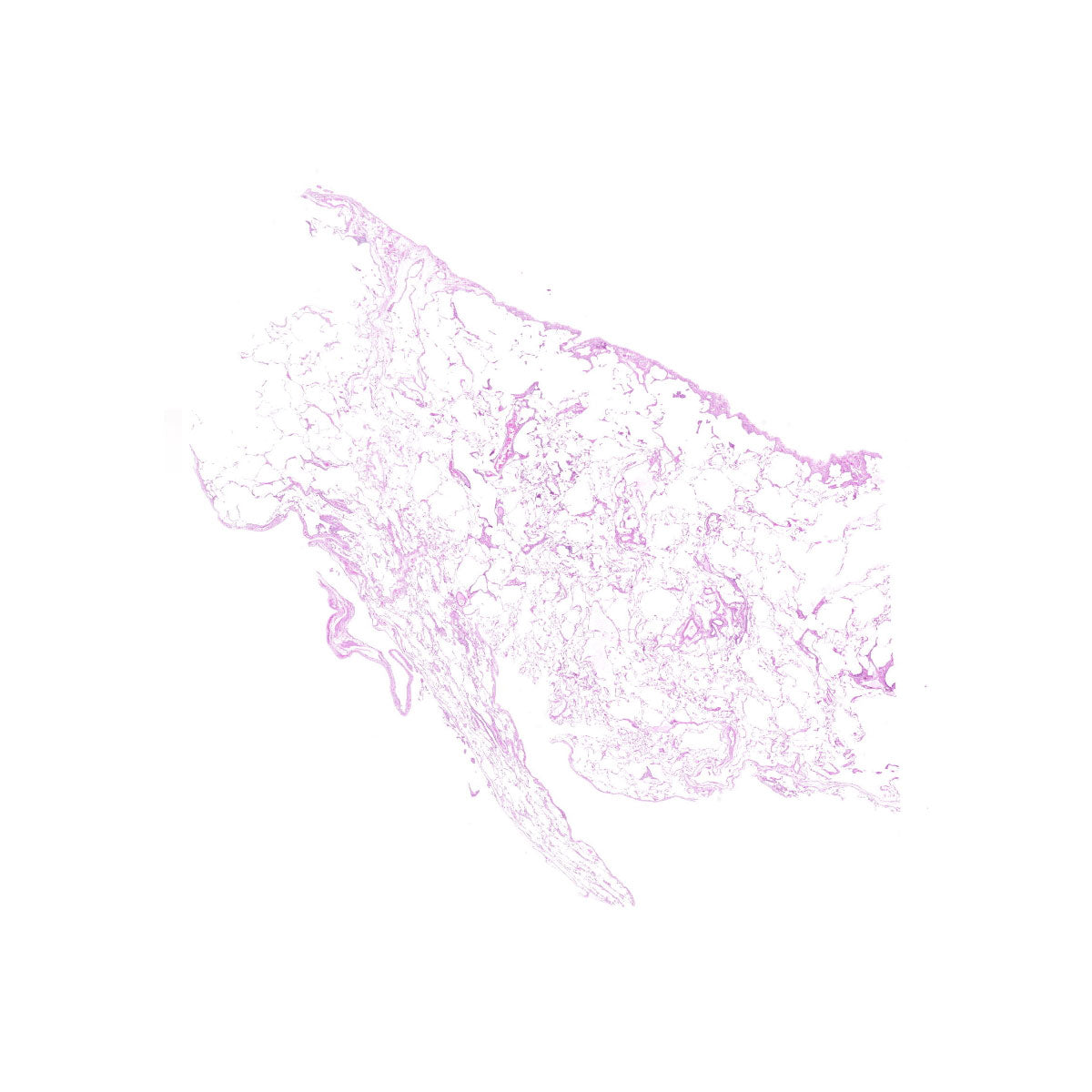 Human FFPE NAT Lung Tissue HuN-15-0109
