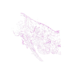 Human FFPE NAT Lung Tissue HuN-15-0109