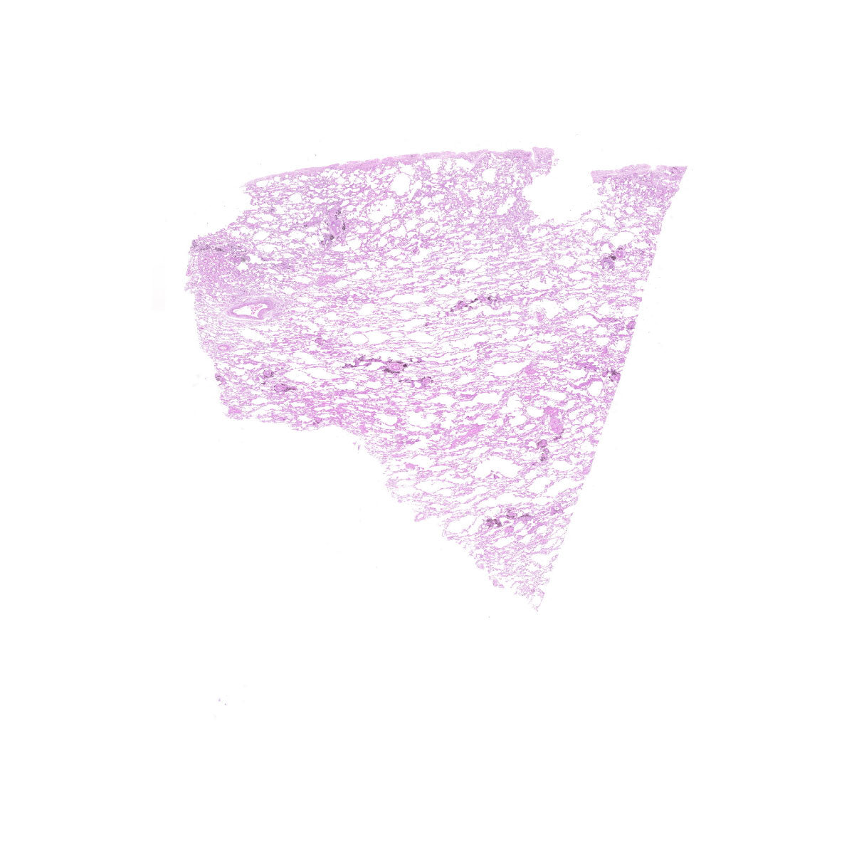 Human FFPE NAT Lung Tissue HuN-15-0110