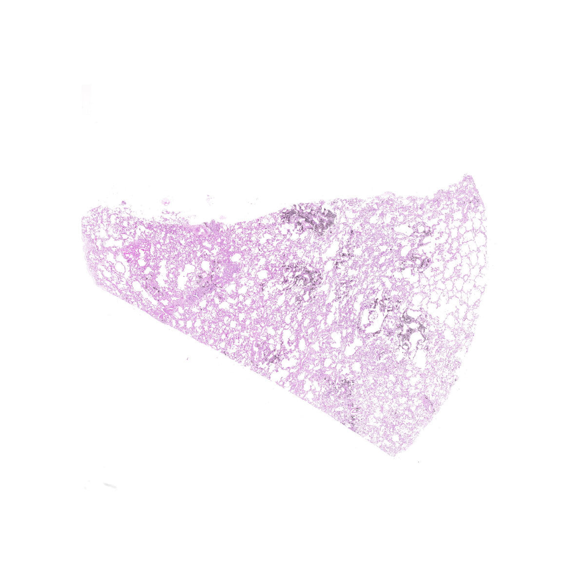 Human FFPE NAT Lung Tissue HuN-15-0112