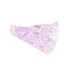 Human FFPE NAT Lung Tissue HuN-15-0112