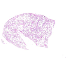 Human FFPE NAT Lung Tissue HuN-15-0113
