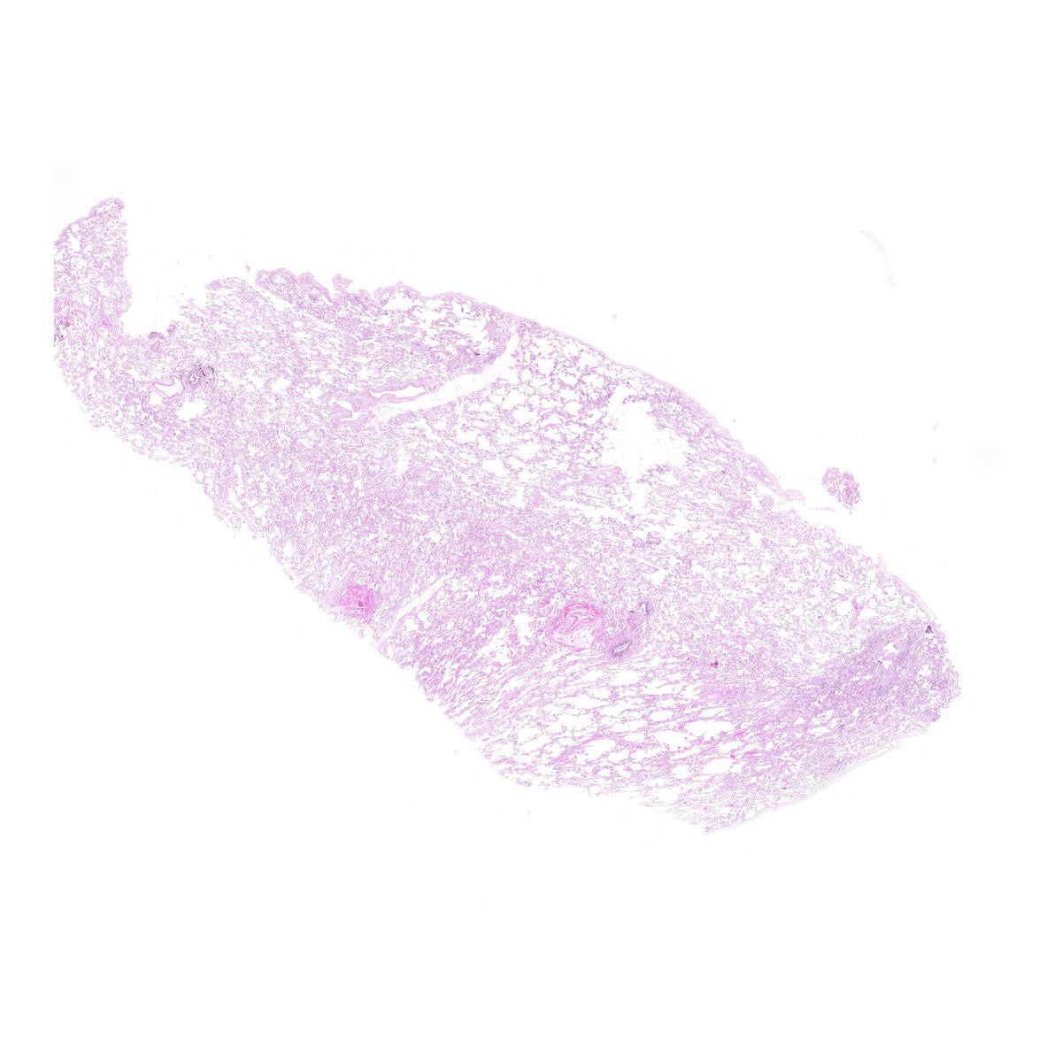 Human FFPE NAT Lung Tissue HuN-15-0114