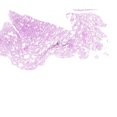 Human FFPE NAT Lung Tissue HuN-15-0115B