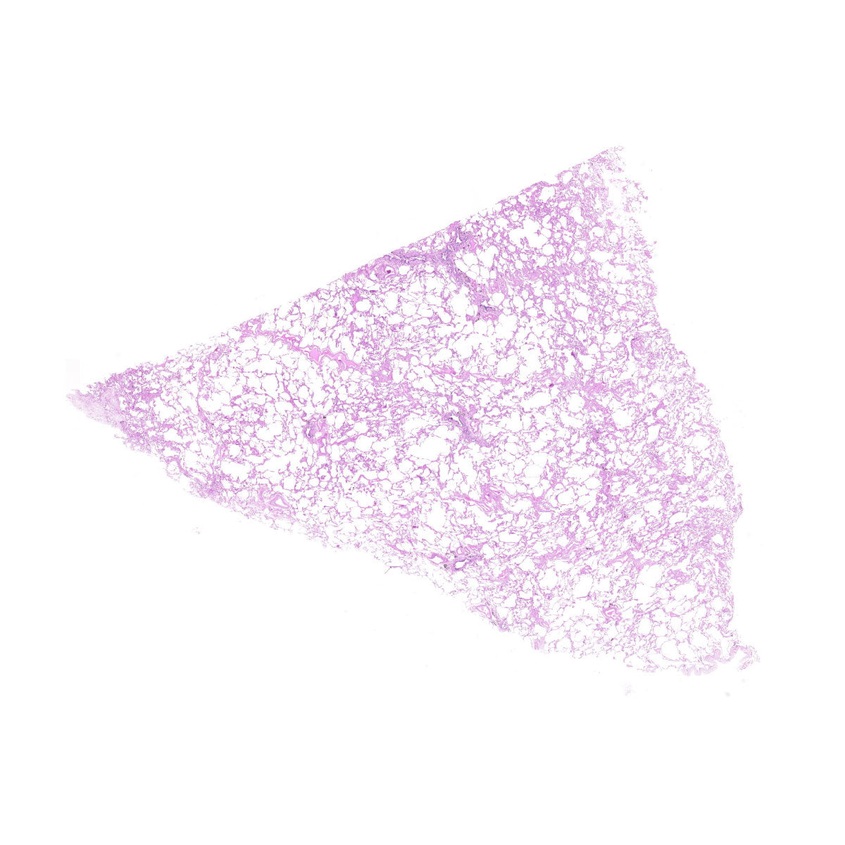 Human FFPE NAT Lung Tissue HuN-15-0116
