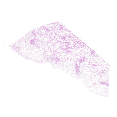 Human FFPE NAT Lung Tissue HuN-15-0117