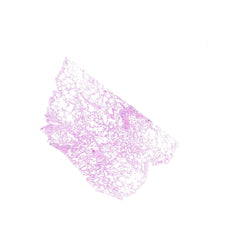 Human FFPE NAT Lung Tissue HuN-15-0118A