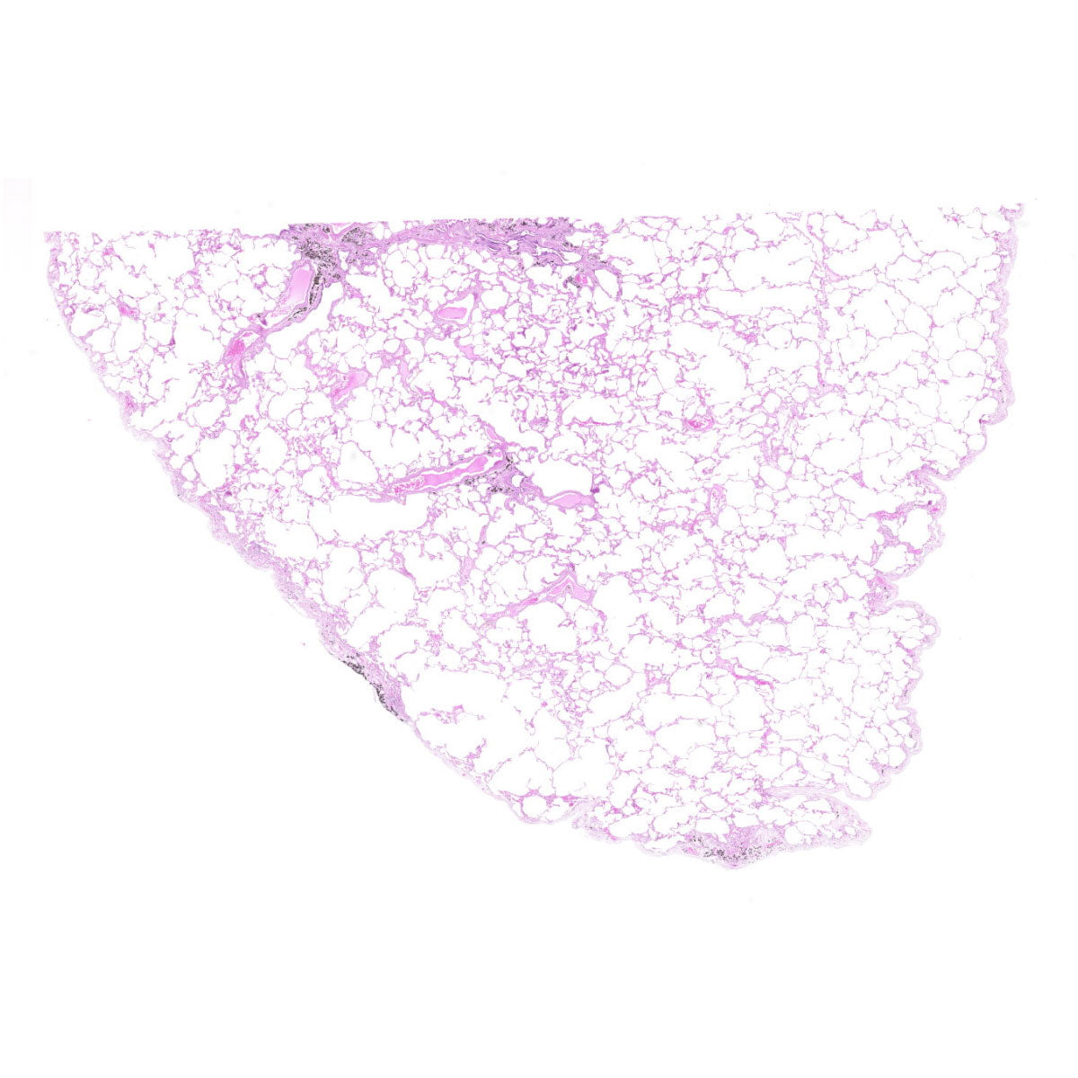 Human FFPE NAT Lung Tissue HuN-15-0118B
