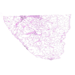 Human FFPE NAT Lung Tissue HuN-15-0118B