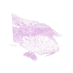 Human FFPE NAT Lung Tissue HuN-15-0119