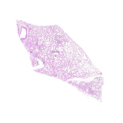 Human FFPE NAT Lung Tissue HuN-15-0120