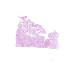 Human FFPE NAT Lung Tissue HuN-15-0121