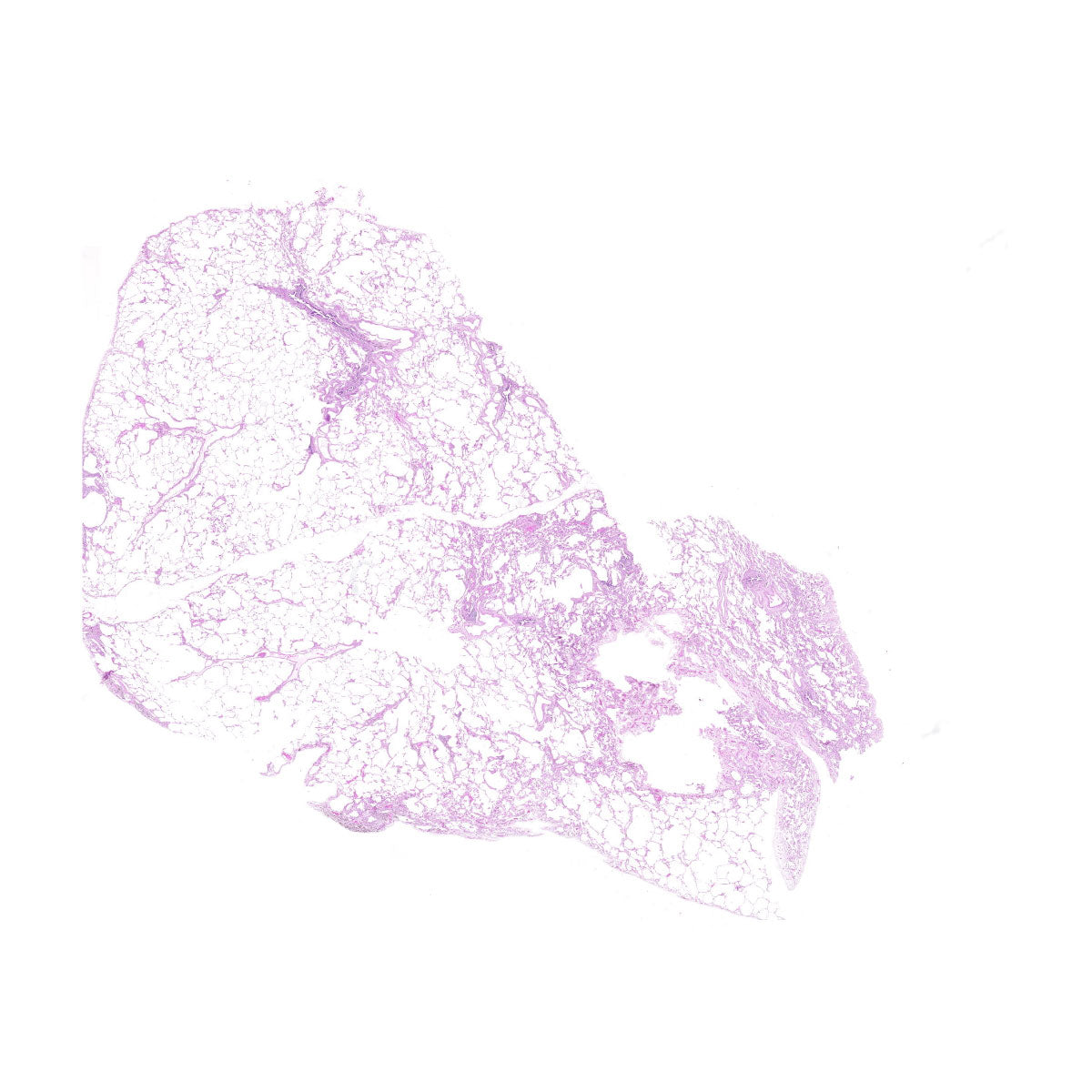 Human FFPE NAT Lung Tissue HuN-15-0122