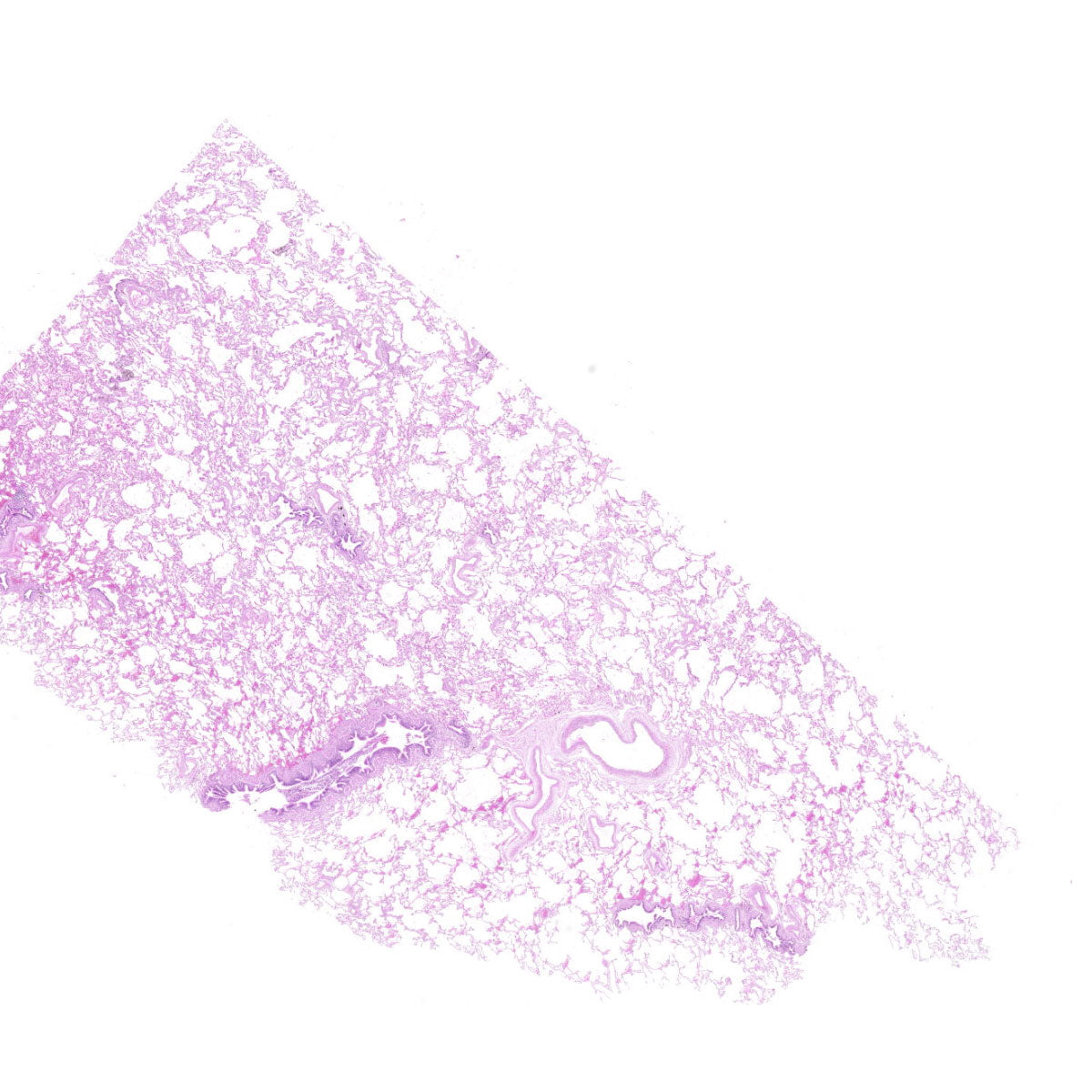 Human FFPE NAT Lung Tissue HuN-15-0123A