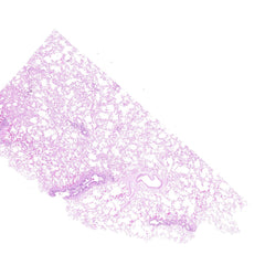Human FFPE NAT Lung Tissue HuN-15-0123A