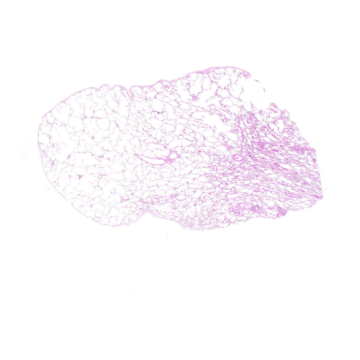 Human FFPE NAT Lung Tissue HuN-15-0126