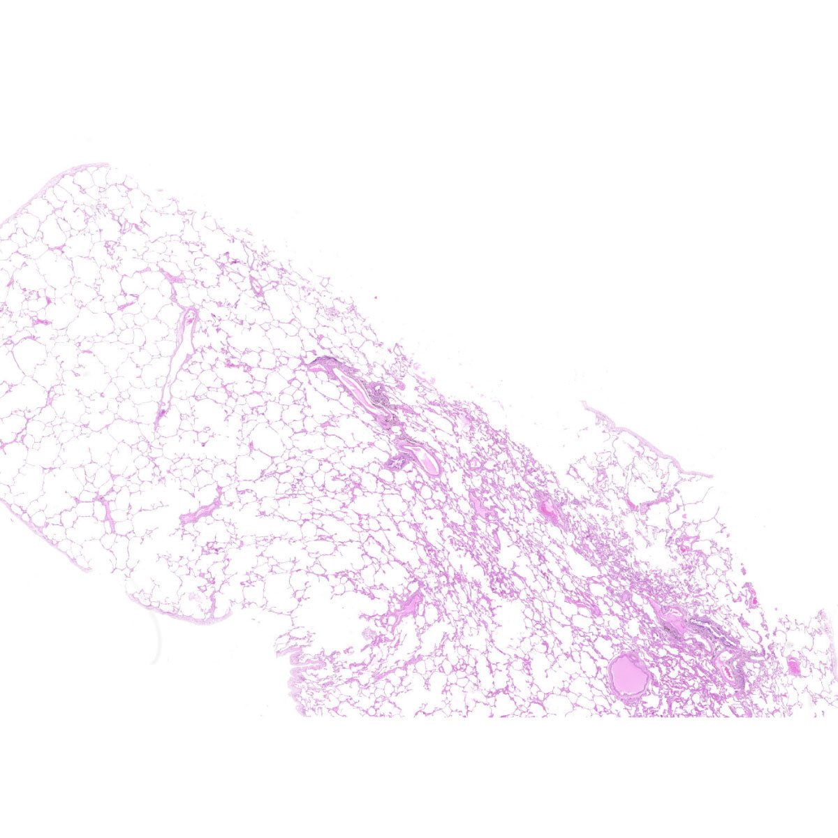 Human FFPE NAT Lung Tissue HuN-15-0127