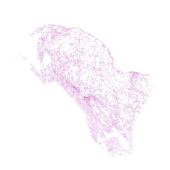 Human FFPE NAT Lung Tissue HuN-15-0128B
