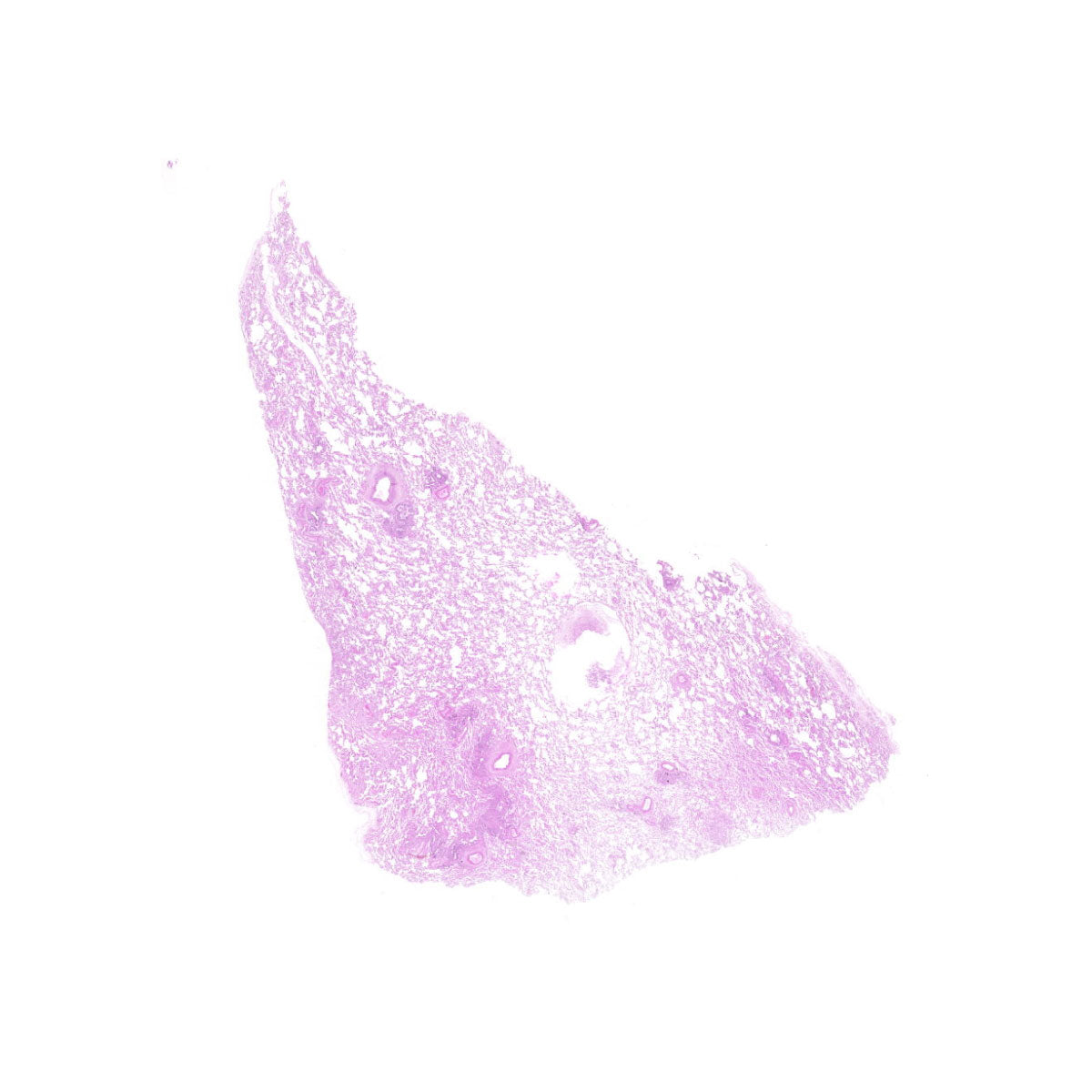 Human FFPE NAT Lung Tissue HuN-15-0129