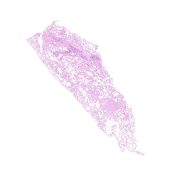 Human FFPE NAT Lung Tissue HuN-15-0130