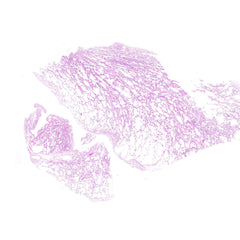 Human FFPE NAT Lung Tissue HuN-15-0131