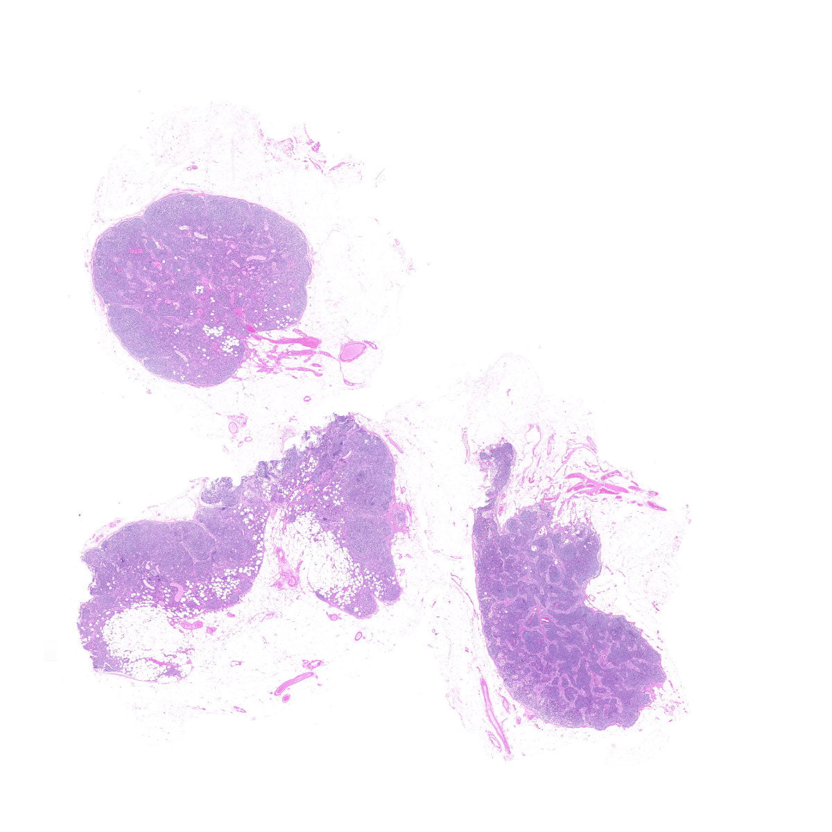 Human FFPE NAT Lymph Node Tissue HuN-16-0024