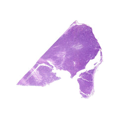 Human FFPE NAT Lymph Node Tissue HuN-16-0027A