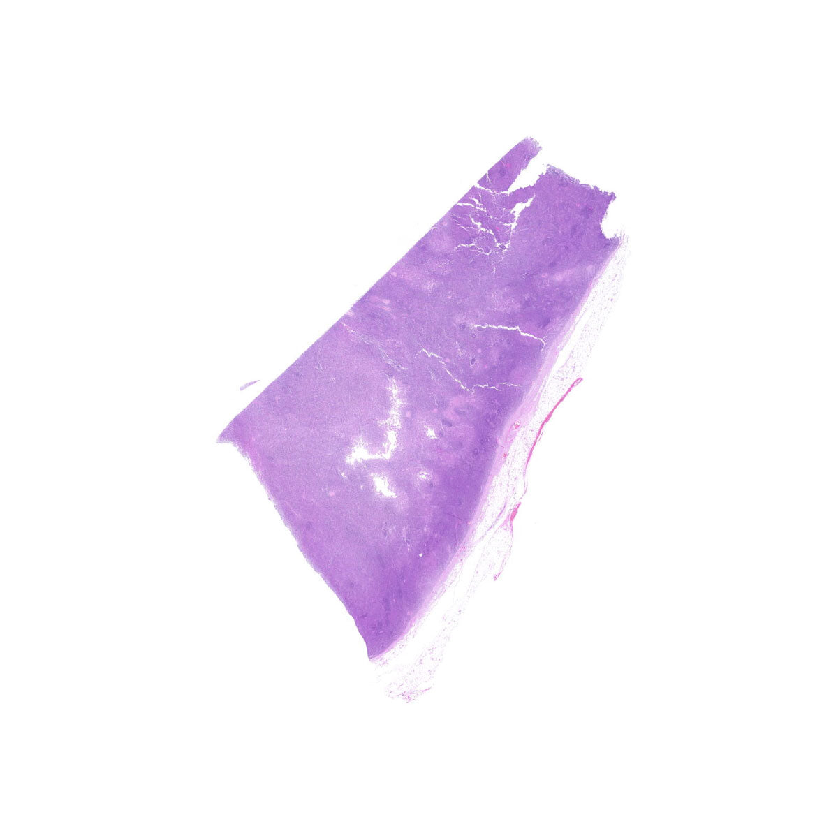 Human FFPE NAT Lymph Node Tissue HuN-16-0029B