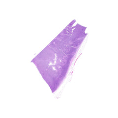 Human FFPE NAT Lymph Node Tissue HuN-16-0029B