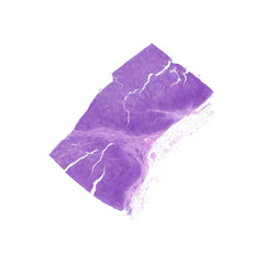 Human FFPE NAT Lymph Node Tissue HuN-16-0030A