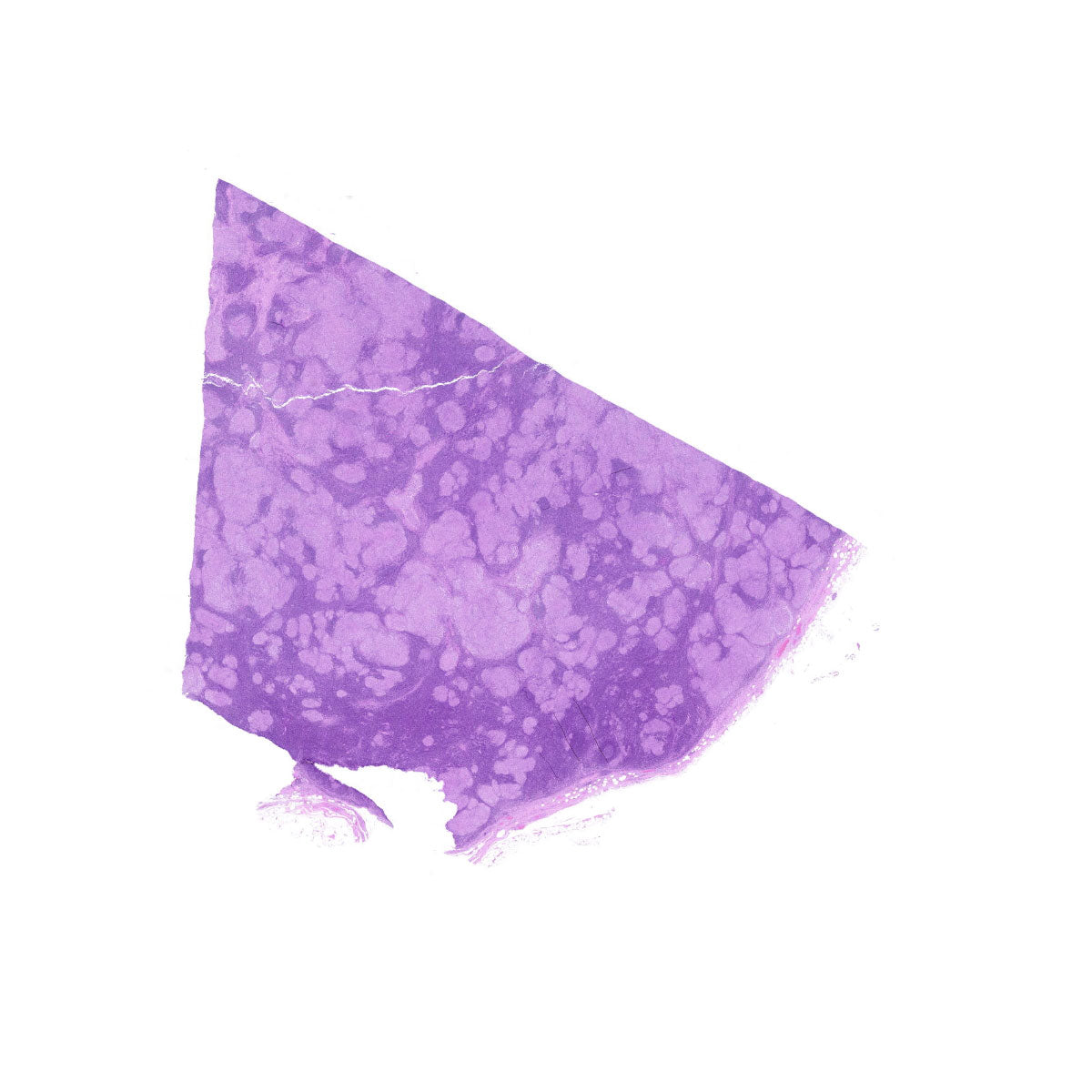 Human FFPE NAT Lymph Node Tissue HuN-16-0031A