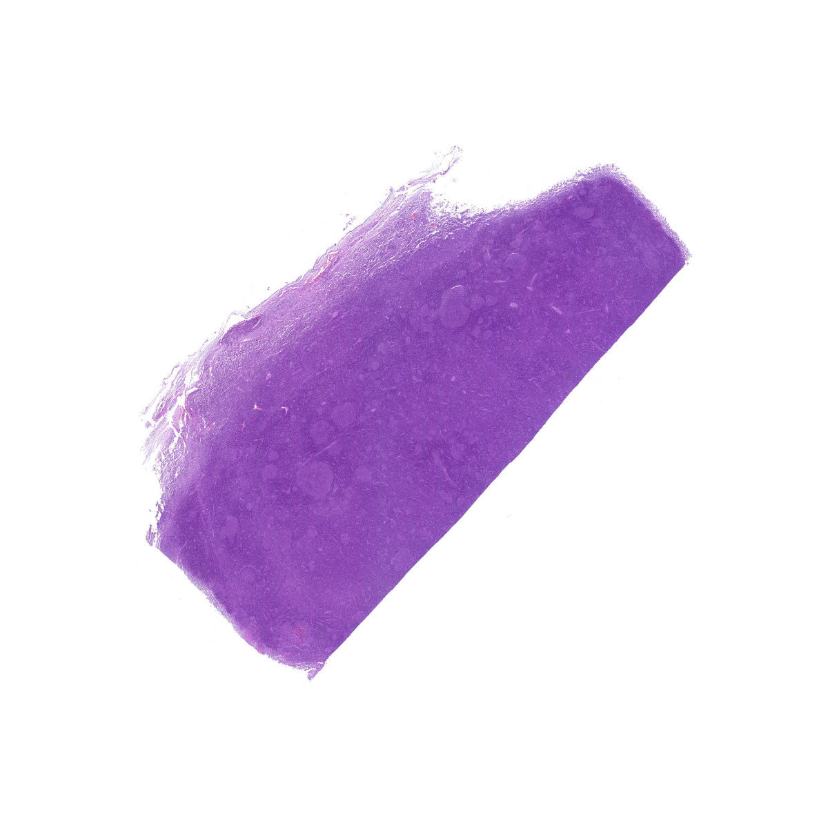 Human FFPE NAT Lymph Node Tissue HuN-16-0032A