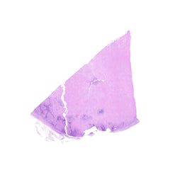 Human FFPE NAT Lymph Node Tissue HuN-16-0033A