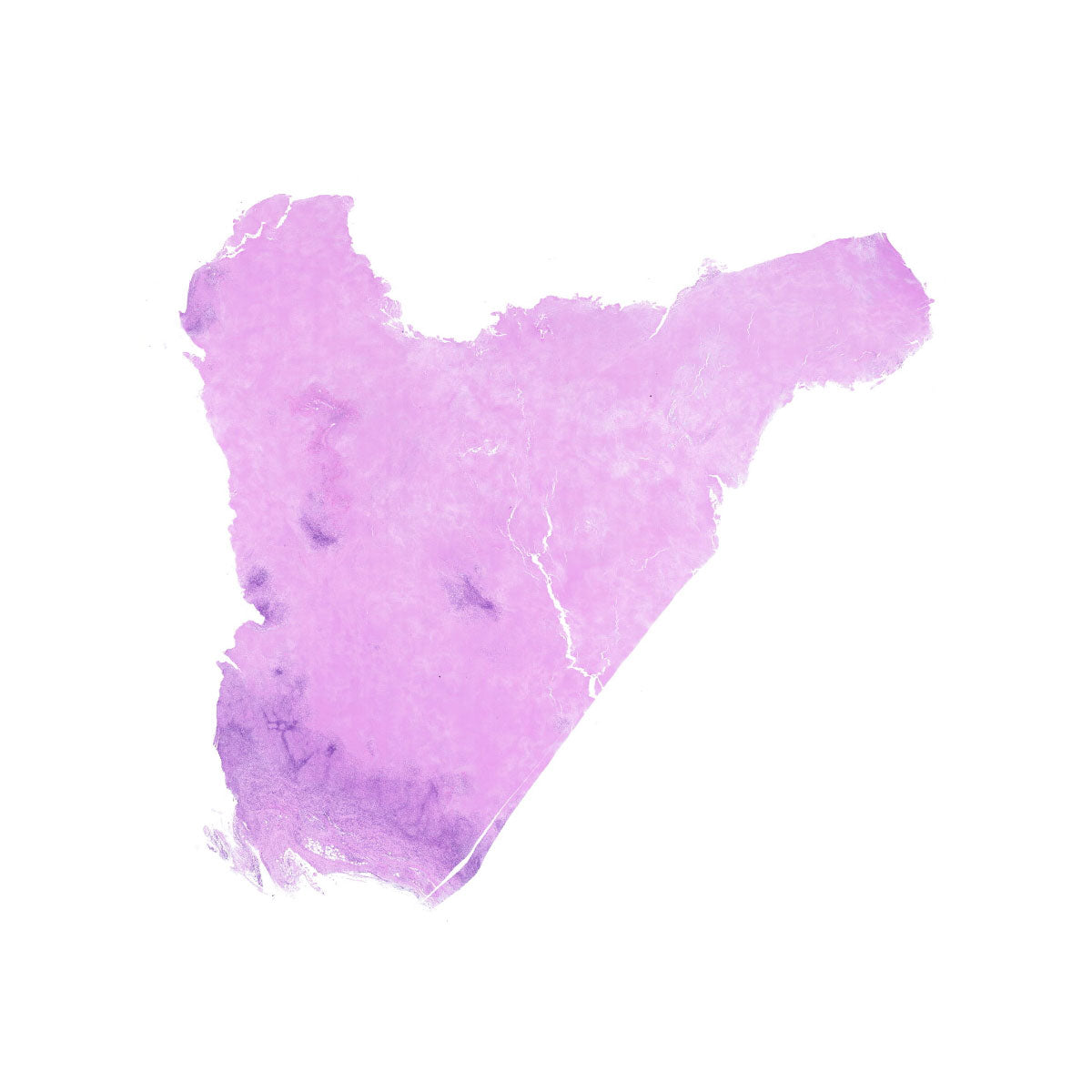 Human FFPE NAT Lymph Node Tissue HuN-16-0033B