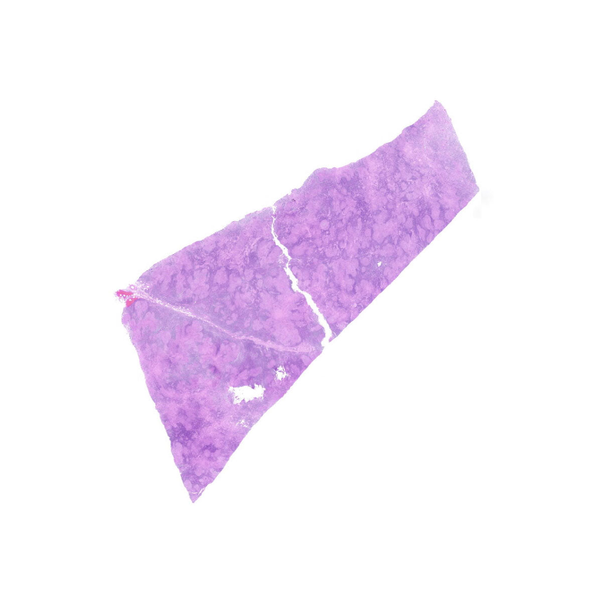 Human FFPE NAT Lymph Node Tissue HuN-16-0035A