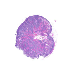 Human FFPE NAT Lymph Node Tissue HuN-16-0046