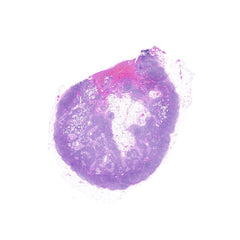 Human FFPE NAT Lymph Node Tissue HuN-16-0047