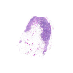 Human FFPE NAT Lymph Node Tissue HuN-16-0048